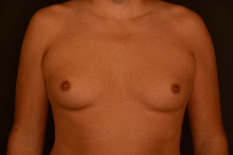 Männerbrust Ansicht