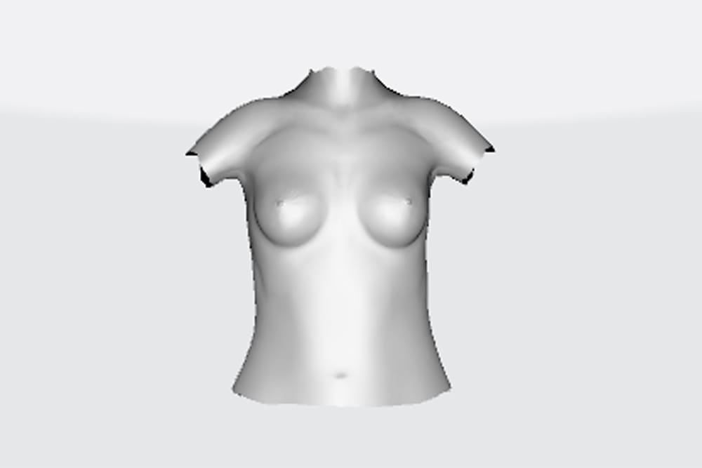 Simulation mit 205 ccm Implantat