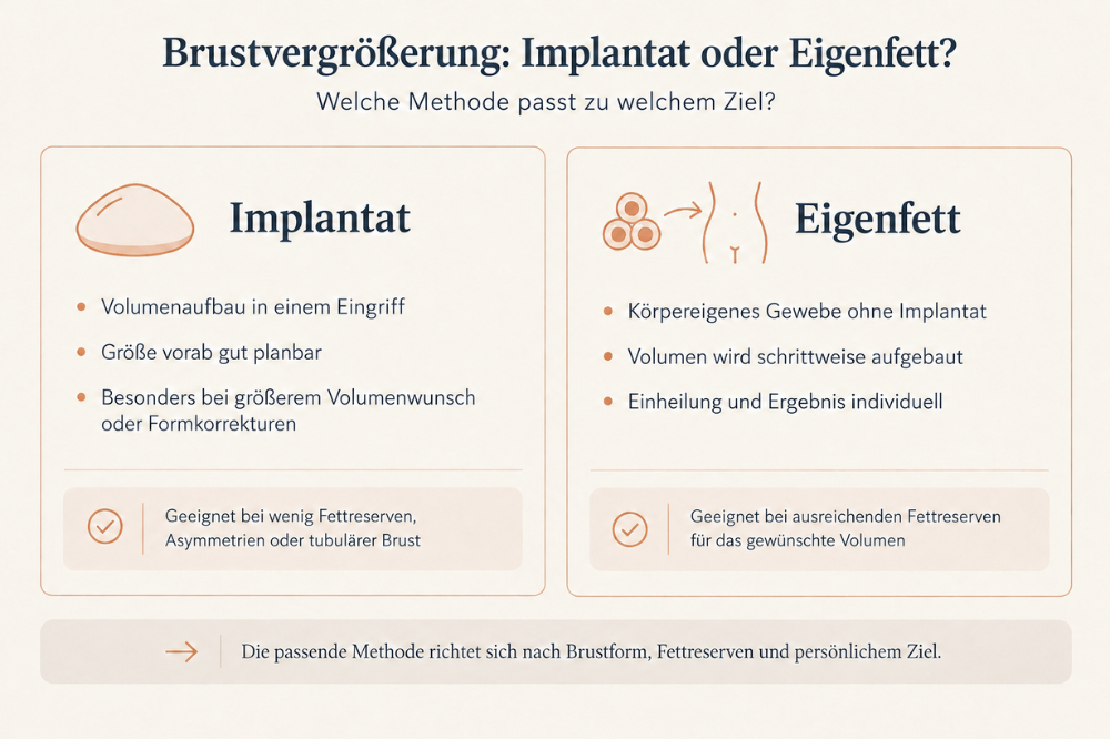 Brustvergrößerung mit Implantat oder Eigenfett im Vergleich